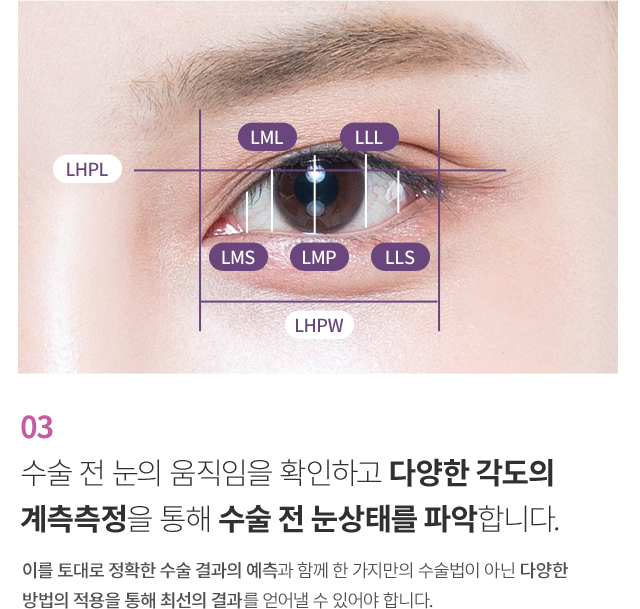 ���������ܰ� �������� ����