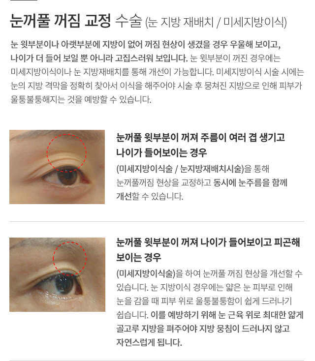 ���̿� ���� ������ ����