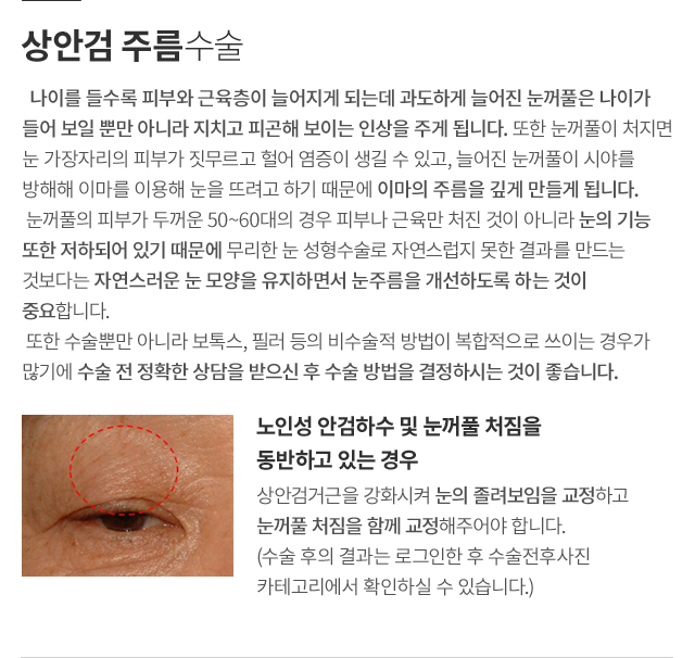 ���̿� ���� ������ ����