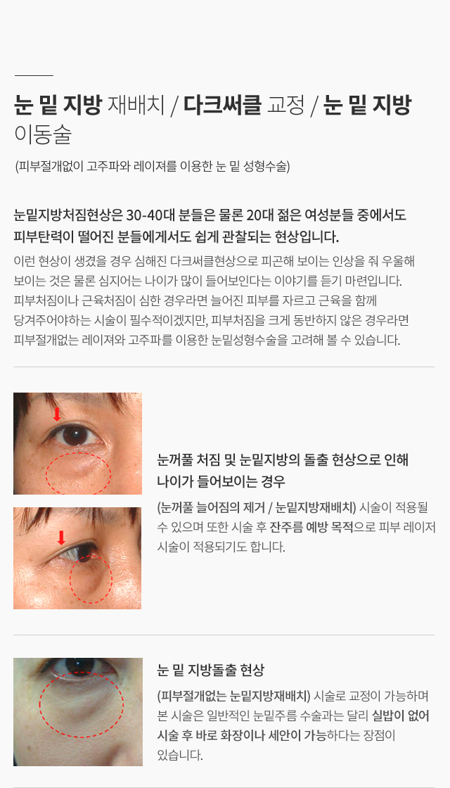 ���̿� ���� ������ ����