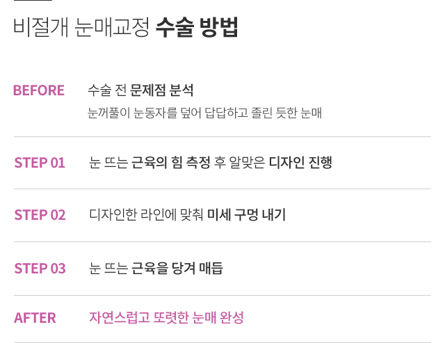 ������ ���ű���