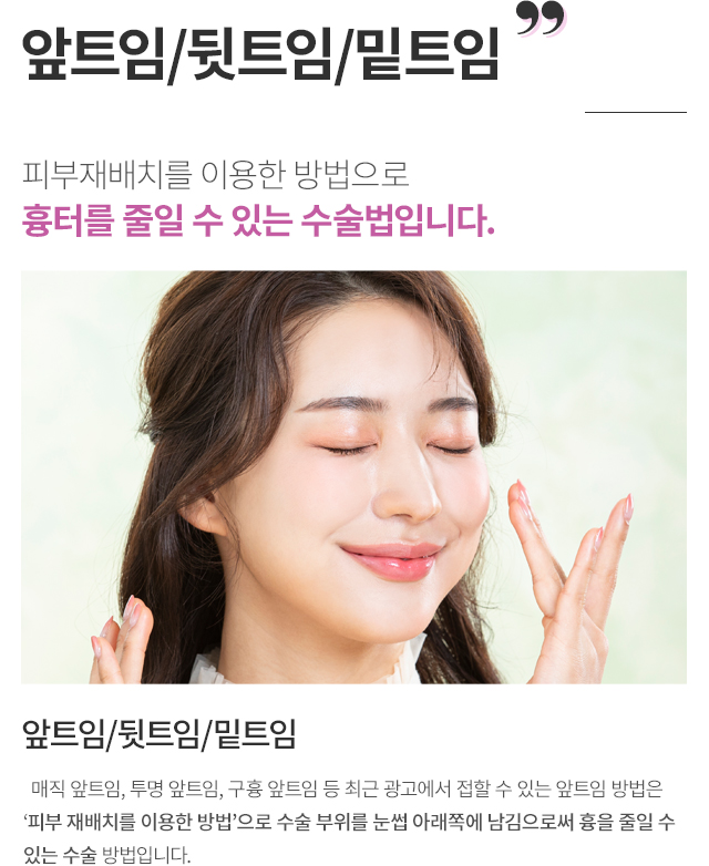 ��Ʈ��/��Ʈ��/��Ʈ��