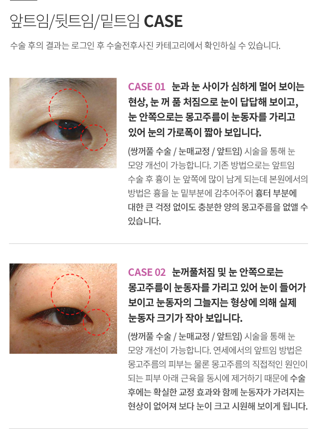 ��Ʈ��/��Ʈ��/��Ʈ��