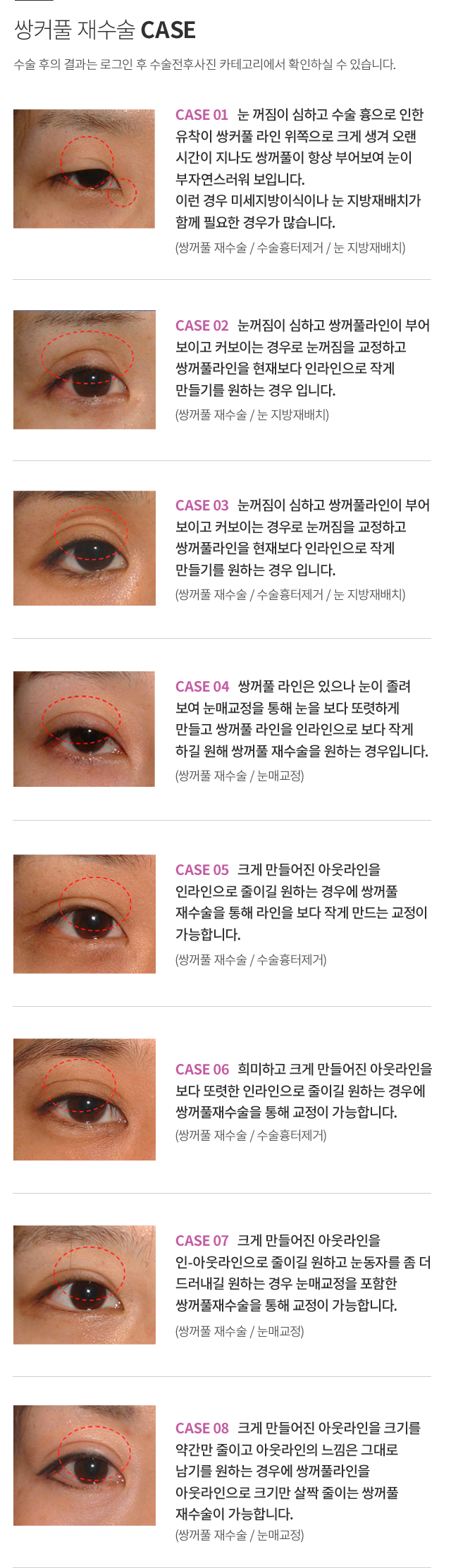 ��ĿǮ �����