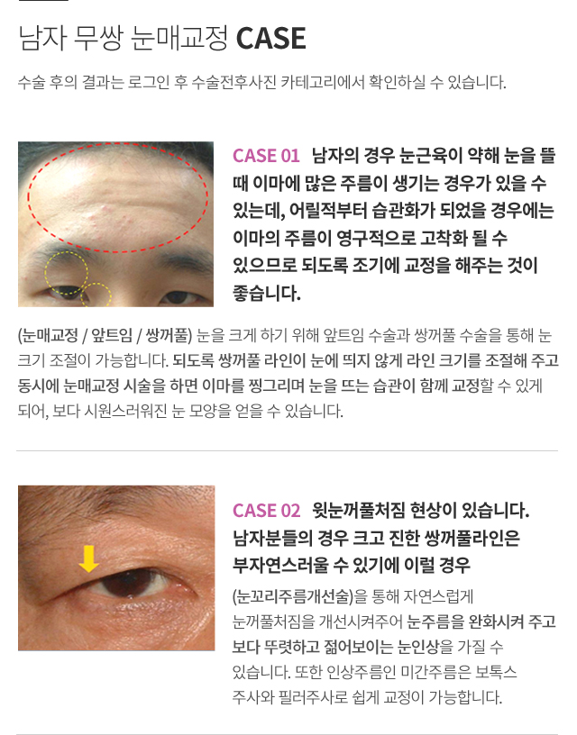 ���� ���ű���