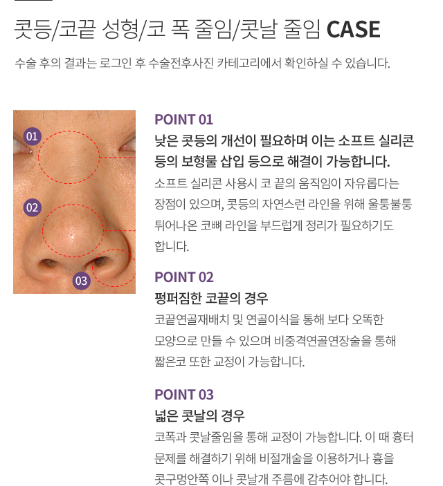 ���/�ڳ� ����/�� �� ����/�೯ ����