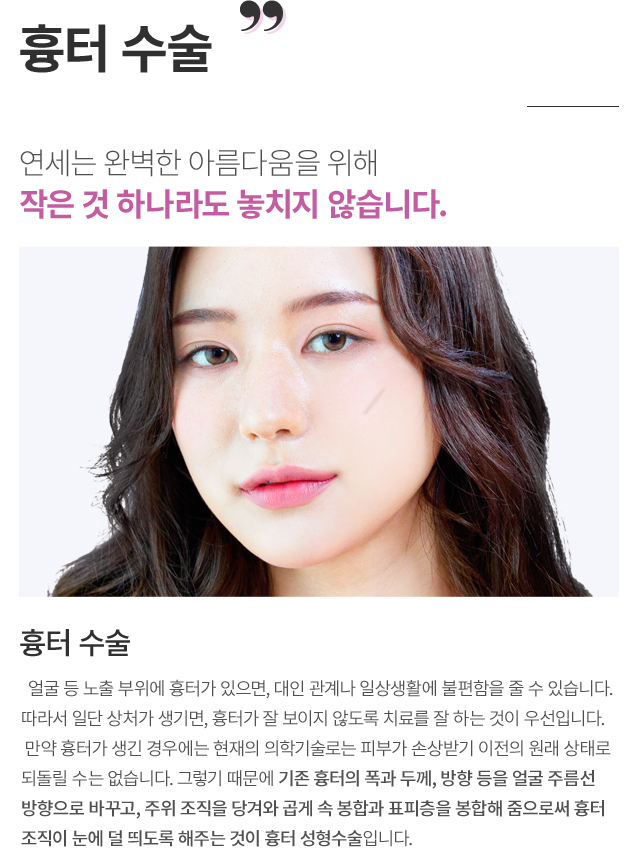 ���ͼ���