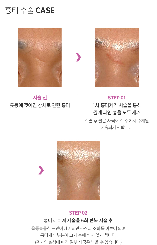 ���ͼ���