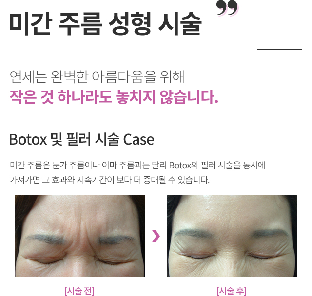 ���ͼ���