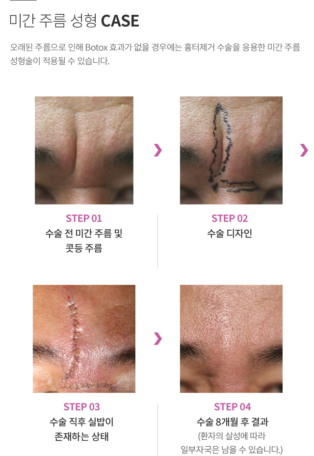 ���ͼ���