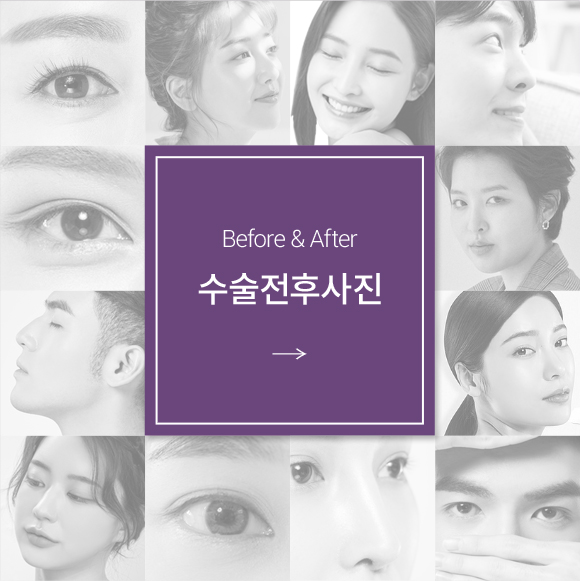 ���� ���� ����