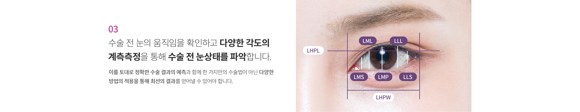 ���������ܰ� �������� ����