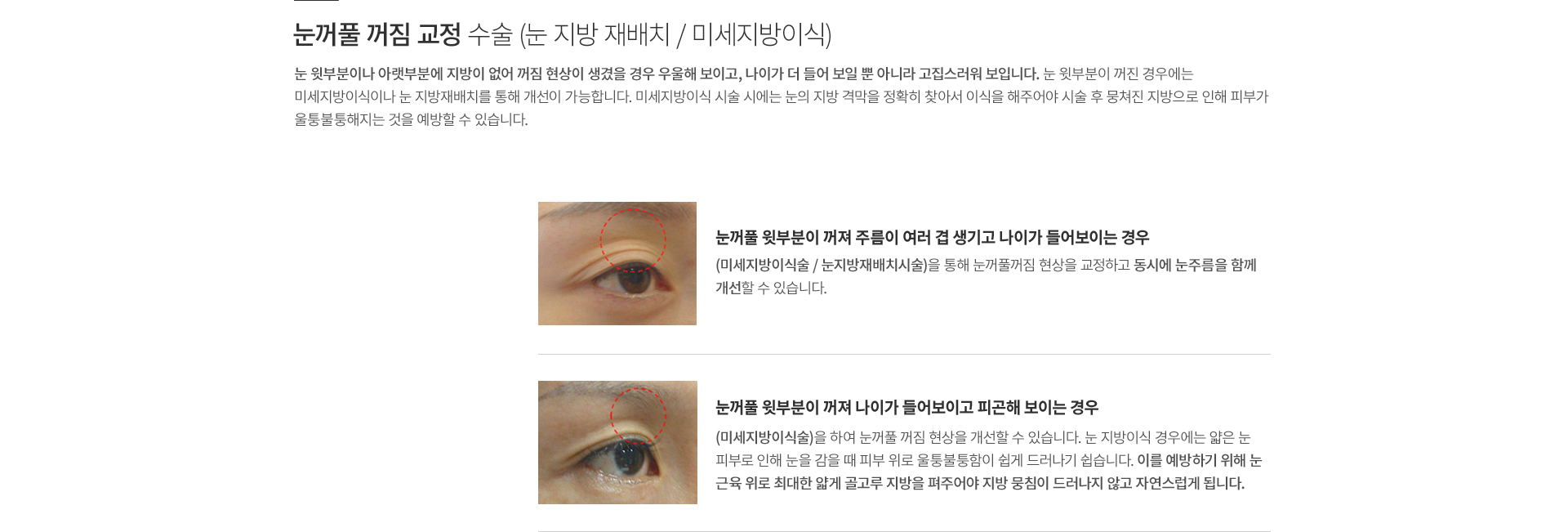 ���̿� ���� ������ ����