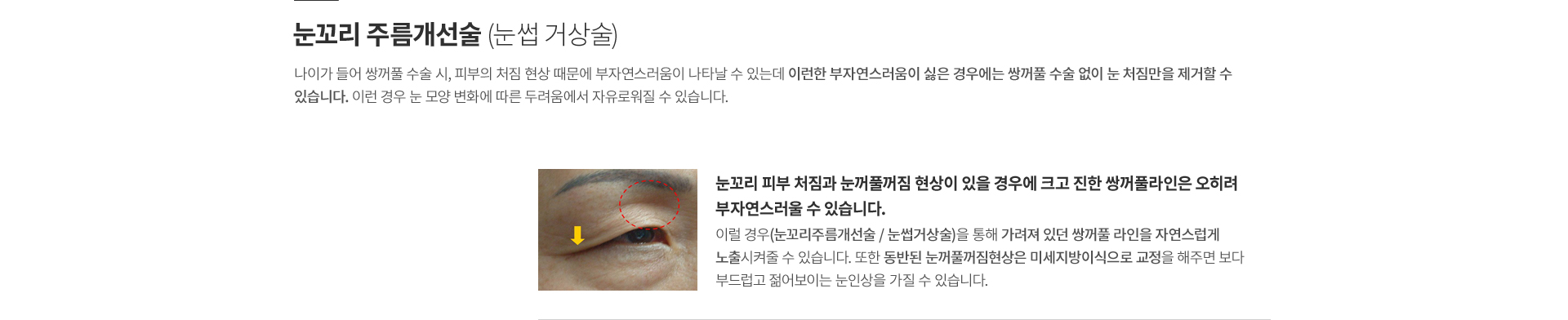 ���̿� ���� ������ ����