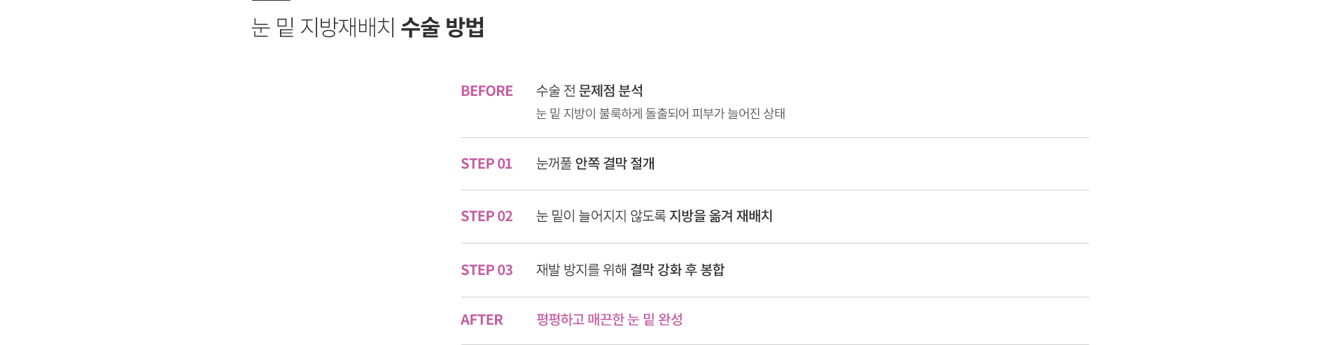 ���� ���ű���