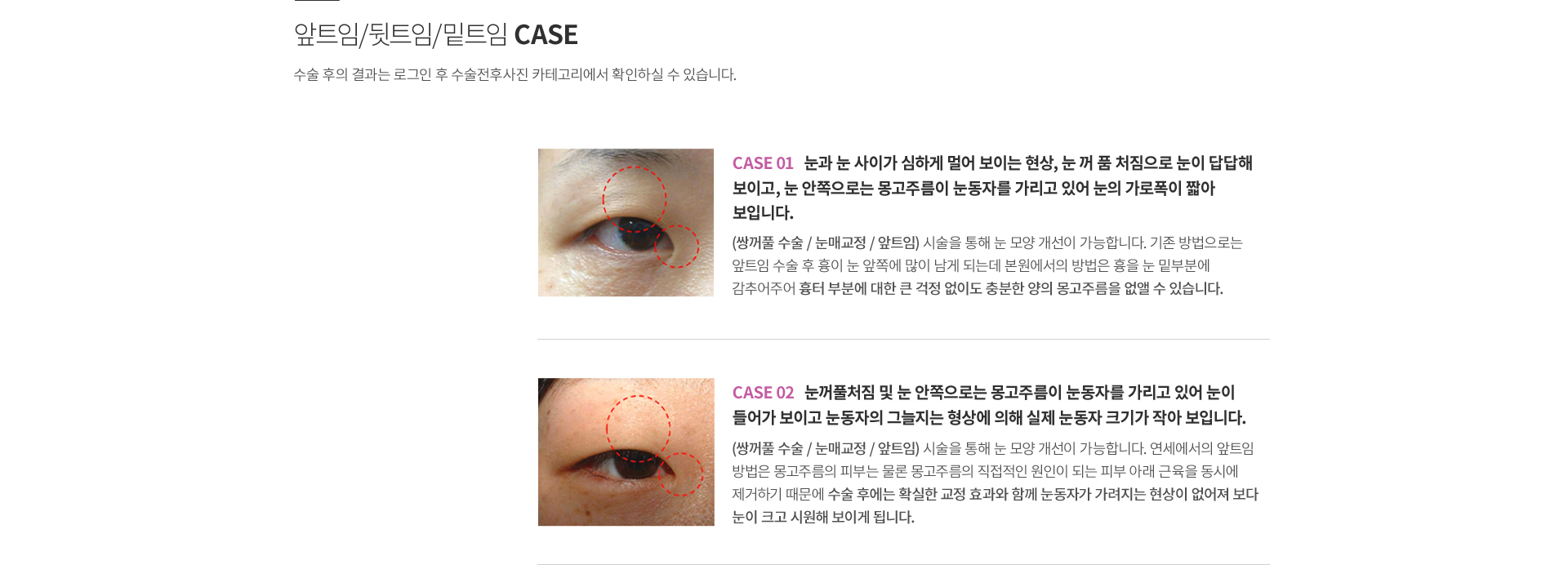 ��Ʈ��/��Ʈ��/��Ʈ��