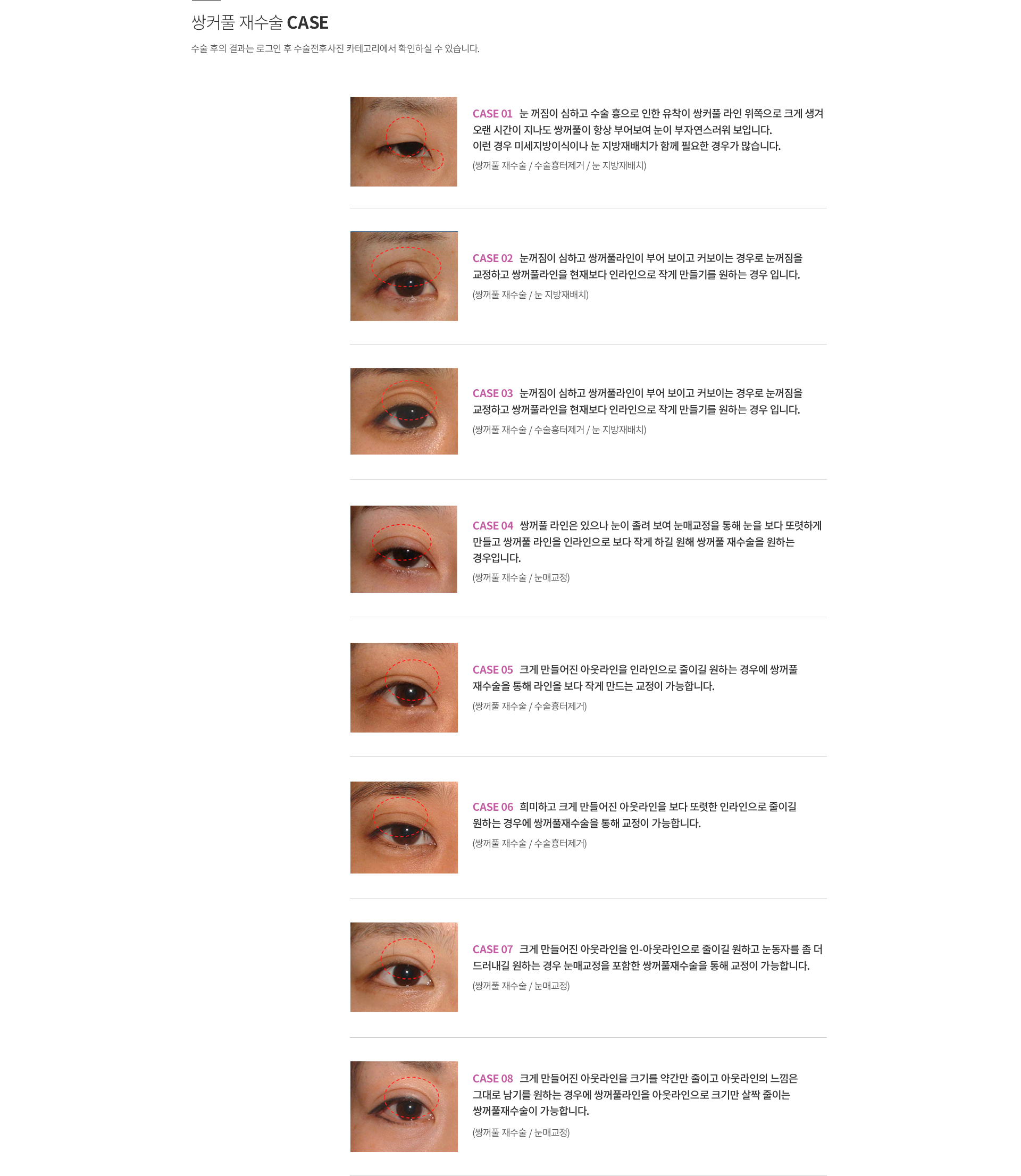 ��ĿǮ �����