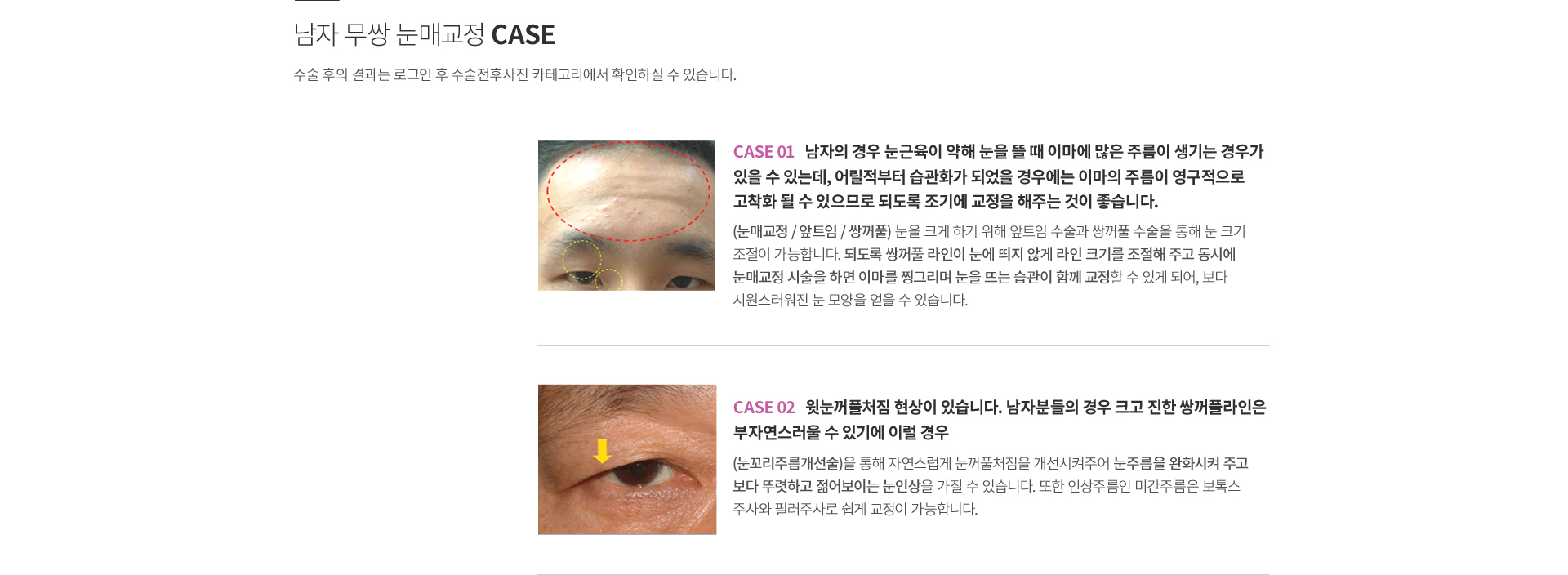 ���� ���ű���