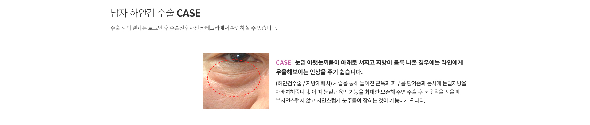 ���� �ϾȰ�