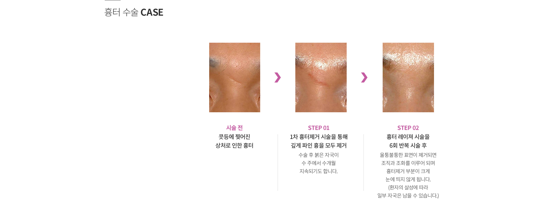 ���ͼ���