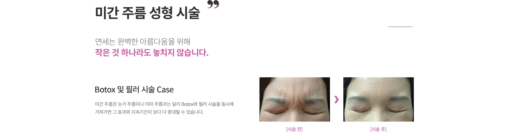 ���ͼ���