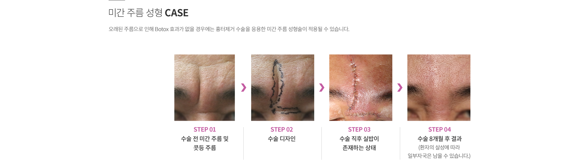 ���ͼ���